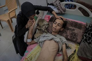 Gaza hladoví. Svaly se rozpadají, děti už přestávají plakat, říká lékař - Seznam Zprávy